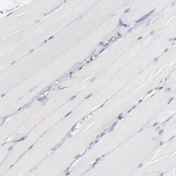 Invitrogen IFI16 Polyclonal Antibody 100 &mu;L; Unconjugated:Antibodies,