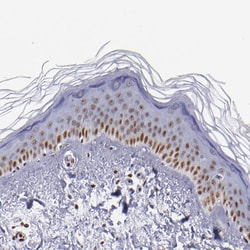 Invitrogen IFI16 Polyclonal Antibody 100 &mu;L; Unconjugated:Antibodies,