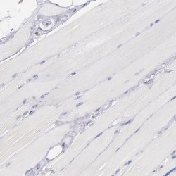 Invitrogen IFI16 Polyclonal Antibody 100 &mu;L; Unconjugated:Antibodies,
