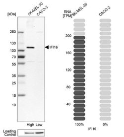 Invitrogen IFI16 Polyclonal Antibody 100 &mu;L; Unconjugated:Antibodies,