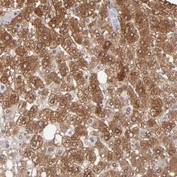 Invitrogen Aldolase B Polyclonal Antibody 100 &mu;L; Unconjugated:Antibodies,