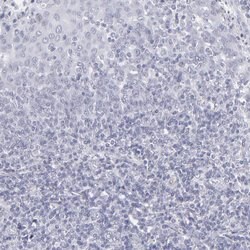 Invitrogen Aldolase B Polyclonal Antibody 100 &mu;L; Unconjugated:Antibodies,