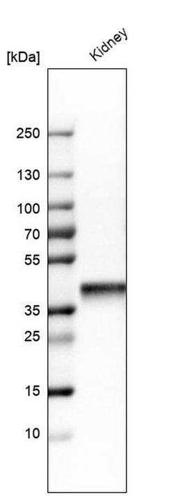 Invitrogen Aldolase B Polyclonal Antibody 100 &mu;L; Unconjugated:Antibodies,