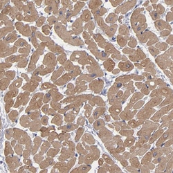Invitrogen CCDC80 Polyclonal Antibody 100 &mu;L; Unconjugated:Antibodies,