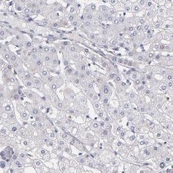Invitrogen MGAM Polyclonal Antibody 100 &mu;L; Unconjugated:Antibodies,