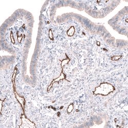 Invitrogen PLVAP Polyclonal Antibody 100 &mu;L | Buy Online | Invitrogen&trade; | Fisher Scientific