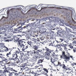 Invitrogen GOLIM4 Polyclonal Antibody 100 &mu;L; Unconjugated:Antibodies,