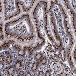 Invitrogen GOLIM4 Polyclonal Antibody 100 &mu;L; Unconjugated:Antibodies,