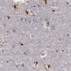 Invitrogen GOLIM4 Polyclonal Antibody 100 &mu;L; Unconjugated:Antibodies,
