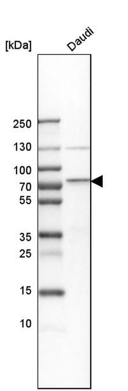 Invitrogen cIAP2 Polyclonal Antibody 100 &mu;L; Unconjugated:Antibodies,