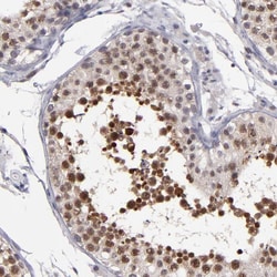 Invitrogen OTUB2 Polyclonal Antibody 100 &mu;L; Unconjugated:Antibodies,