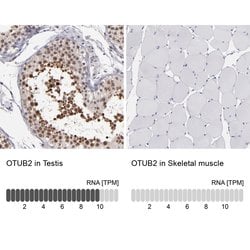 Invitrogen OTUB2 Polyclonal Antibody 100 &mu;L; Unconjugated:Antibodies,