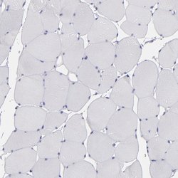Invitrogen OTUB2 Polyclonal Antibody 100 &mu;L; Unconjugated:Antibodies,