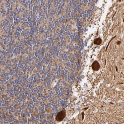 Invitrogen BTG2 Polyclonal Antibody 100 &mu;L; Unconjugated:Antibodies,