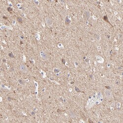 Invitrogen BTG2 Polyclonal Antibody 100 &mu;L; Unconjugated:Antibodies,