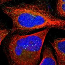 Invitrogen SLMAP Polyclonal Antibody 100 &mu;L; Unconjugated:Antibodies,