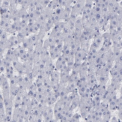 Invitrogen SLMAP Polyclonal Antibody 100 &mu;L; Unconjugated:Antibodies,