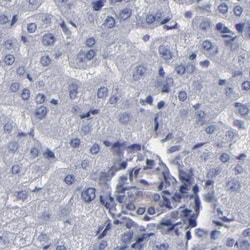 Invitrogen SLMAP Polyclonal Antibody 100 &mu;L; Unconjugated:Antibodies,