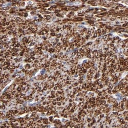 Invitrogen SLMAP Polyclonal Antibody 100 &mu;L; Unconjugated:Antibodies,