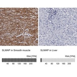 Invitrogen SLMAP Polyclonal Antibody 100 &mu;L; Unconjugated:Antibodies,