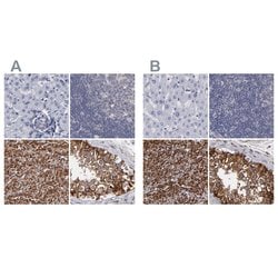 Invitrogen SLMAP Polyclonal Antibody 100 &mu;L; Unconjugated:Antibodies,