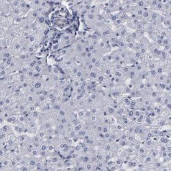 Invitrogen SLMAP Polyclonal Antibody 100 &mu;L; Unconjugated:Antibodies,