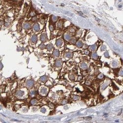 Invitrogen SLMAP Polyclonal Antibody 100 &mu;L; Unconjugated:Antibodies,