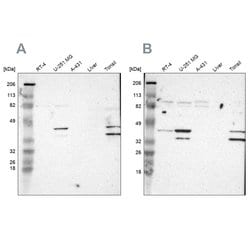 Invitrogen SLMAP Polyclonal Antibody 100 &mu;L; Unconjugated:Antibodies,