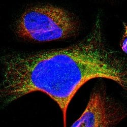 Invitrogen SLMAP Polyclonal Antibody 100 &mu;L; Unconjugated:Antibodies,