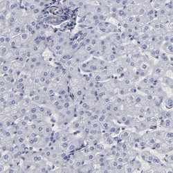 Invitrogen SLMAP Polyclonal Antibody 100 &mu;L; Unconjugated:Antibodies,