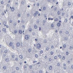 Invitrogen SLMAP Polyclonal Antibody 100 &mu;L; Unconjugated:Antibodies,