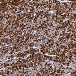 Invitrogen SLMAP Polyclonal Antibody 100 &mu;L; Unconjugated:Antibodies,