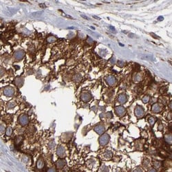 Invitrogen SLMAP Polyclonal Antibody 100 &mu;L; Unconjugated:Antibodies,