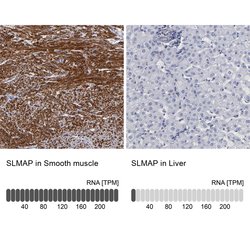 Invitrogen SLMAP Polyclonal Antibody 100 &mu;L; Unconjugated:Antibodies,