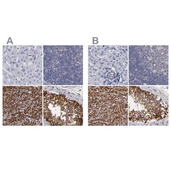Invitrogen SLMAP Polyclonal Antibody 100 &mu;L; Unconjugated:Antibodies,