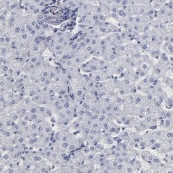 Invitrogen SLMAP Polyclonal Antibody 100 &mu;L; Unconjugated:Antibodies,