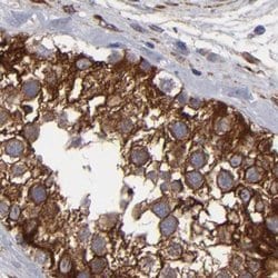 Invitrogen SLMAP Polyclonal Antibody 100 &mu;L; Unconjugated:Antibodies,