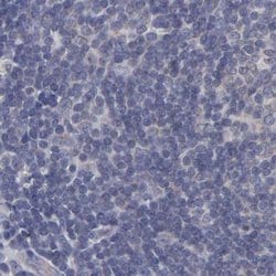Invitrogen SLMAP Polyclonal Antibody 100 &mu;L; Unconjugated:Antibodies,