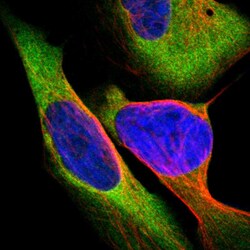 Invitrogen CARS Polyclonal Antibody 100 &mu;L; Unconjugated:Antibodies,