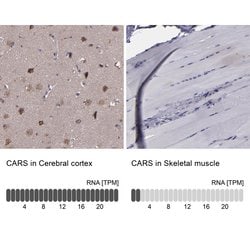 Invitrogen CARS Polyclonal Antibody 100 &mu;L; Unconjugated:Antibodies,