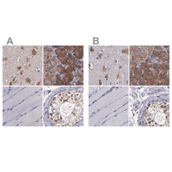 Invitrogen CARS Polyclonal Antibody 100 &mu;L; Unconjugated:Antibodies,