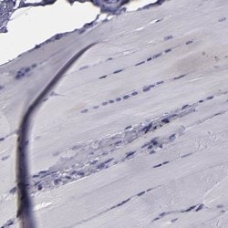 Invitrogen CARS Polyclonal Antibody 100 &mu;L; Unconjugated:Antibodies,