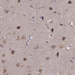 Invitrogen CARS Polyclonal Antibody 100 &mu;L; Unconjugated:Antibodies,