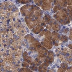 Invitrogen CARS Polyclonal Antibody 100 &mu;L; Unconjugated:Antibodies,