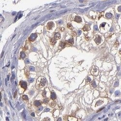 Invitrogen CARS Polyclonal Antibody 100 &mu;L; Unconjugated:Antibodies,