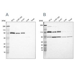 Invitrogen CARS Polyclonal Antibody 100 &mu;L; Unconjugated:Antibodies,