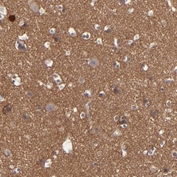 Invitrogen RPH3A Polyclonal Antibody 100 &mu;L; Unconjugated:Antibodies,