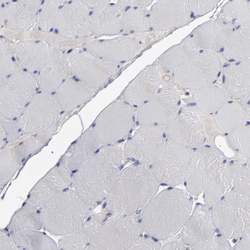 Invitrogen RPH3A Polyclonal Antibody 100 &mu;L; Unconjugated:Antibodies,