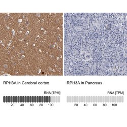 Invitrogen RPH3A Polyclonal Antibody 100 &mu;L; Unconjugated:Antibodies,