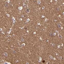 Invitrogen RPH3A Polyclonal Antibody 100 &mu;L; Unconjugated:Antibodies,